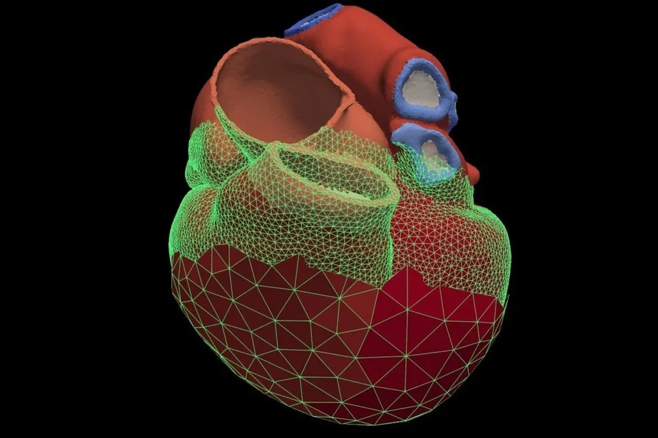 A computer model of a human heart