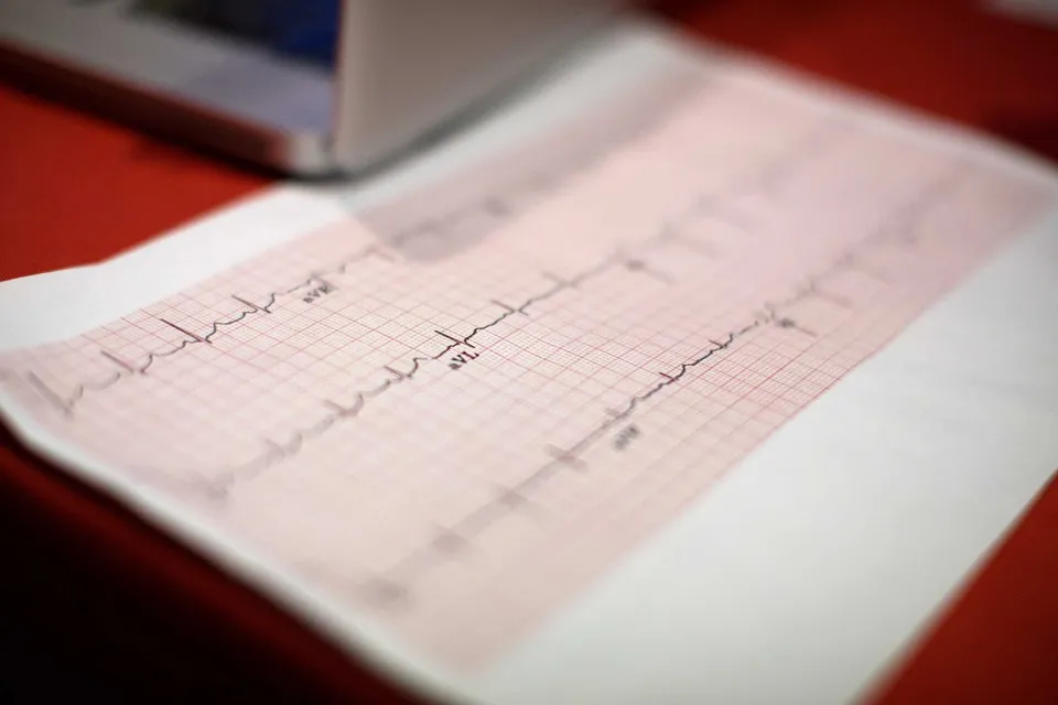 An electrocardiogram printout