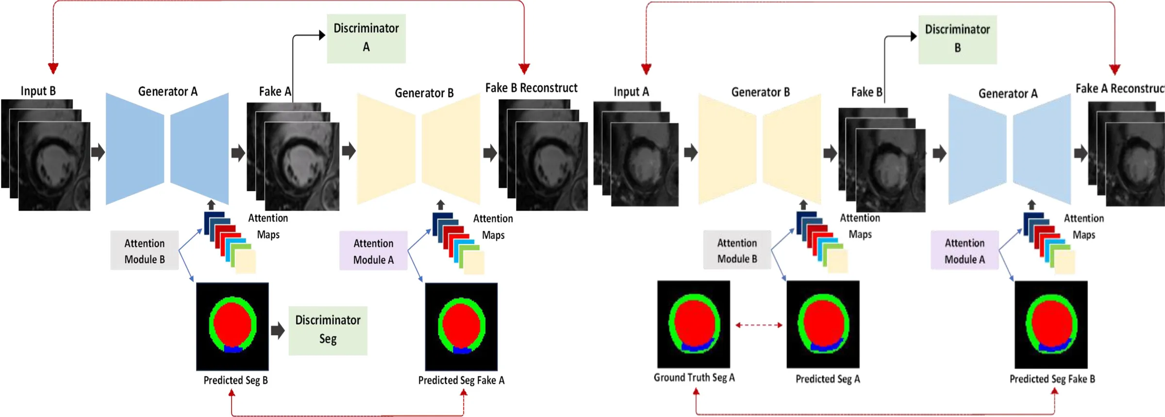 A cycle-consistent generative adversarial network with attention, which maps late gadolinium enhanced MRI from eight days after a myocardial infarction (A) to the style of images at twelve months (B), and back, and segments the images it generates. Figure 4 of Qayyum et al. (2024), Information Fusion, under CC BY 4.0.