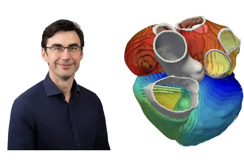 Steven Niederer beside one of the group's four-chamber heart models