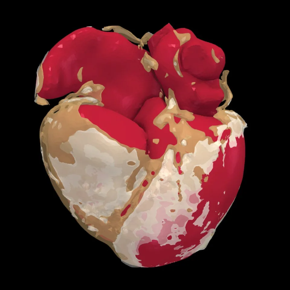 The Heart's Fatty Armour, Tiffany Baptiste's image of a heart model wrapped in layers of fat