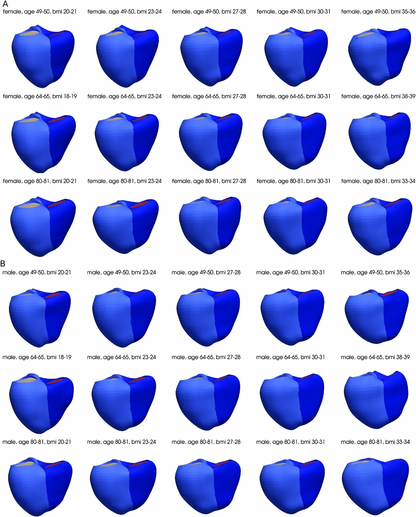 Representative biventricular meshes for different groups of age, sex and body mass index, built from the cardiac MRI of about 55,000 UK Biobank participants. Figure 5 of Ugurlu et al. (2025), PLOS ONE, under CC BY 4.0.